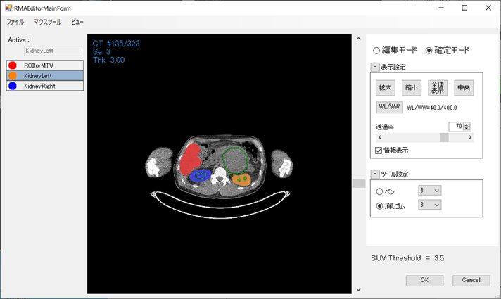 Mask（ROI for MTV）の指定