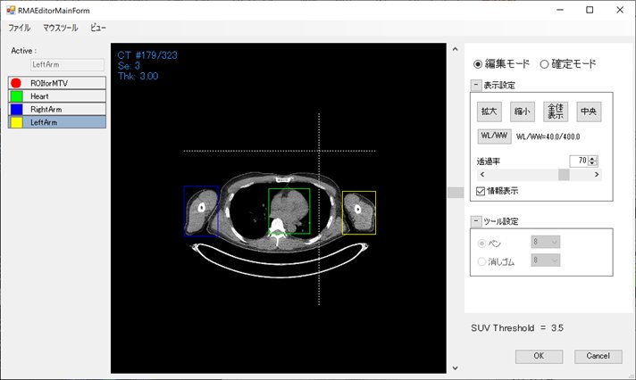 BoundingBoxの指定